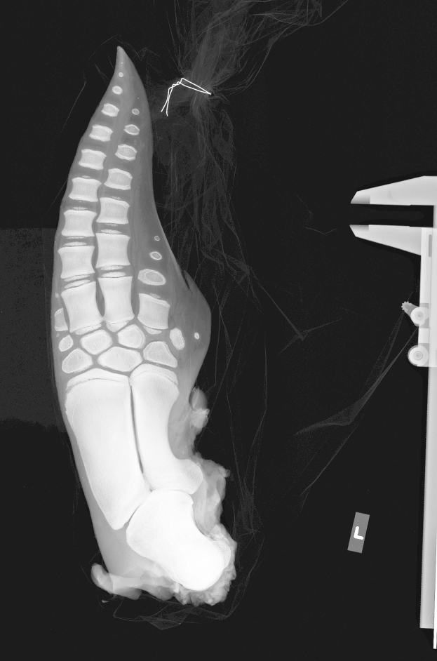Ein R"ontgenbild eines menschlichen Fusses mit einem Bruch in der Mitte, mit einem Ligament auf der rechten Seite, vor einem schwarzen Hintergrund.